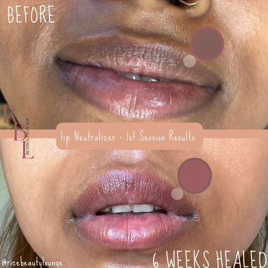 DARK LIP NEUTRALIZER