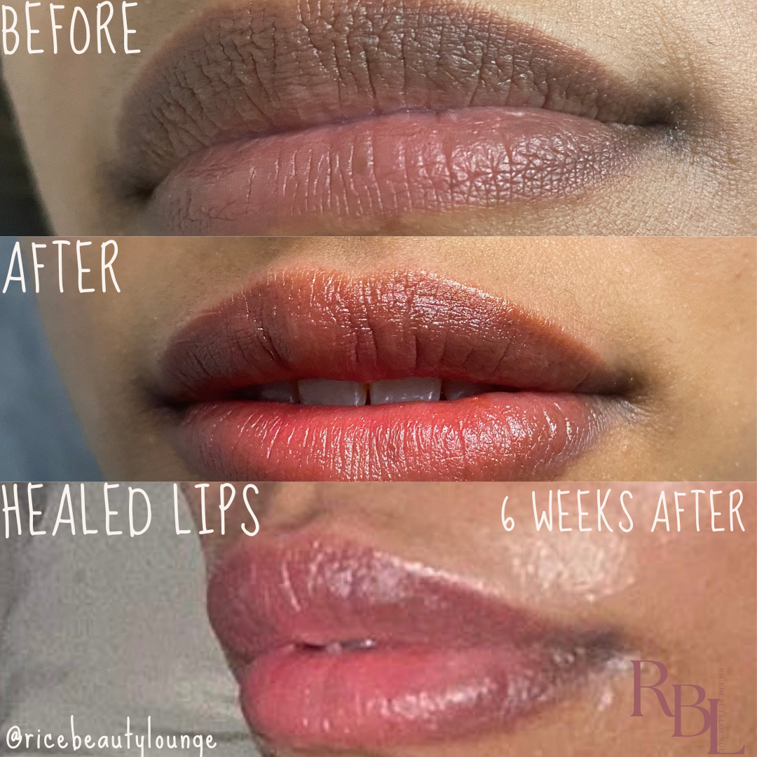 DARK LIP NEUTRALIZER