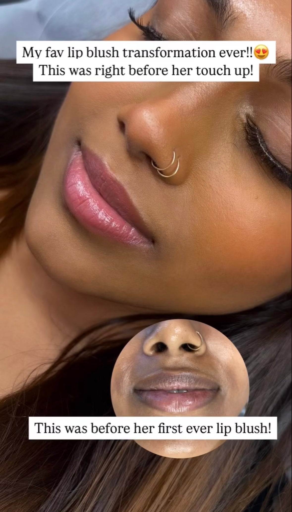 👑 6 Sessions – Ultimate Lip Glow Journey