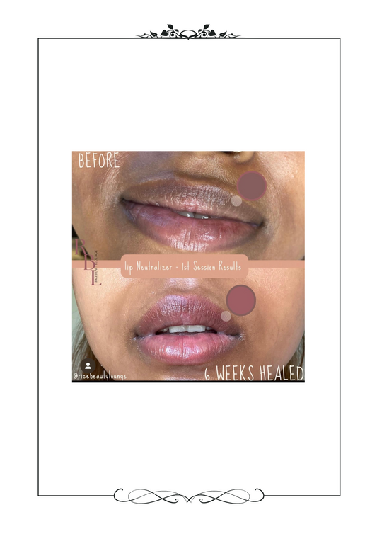 Dark Lip Neutralizer Before vs After