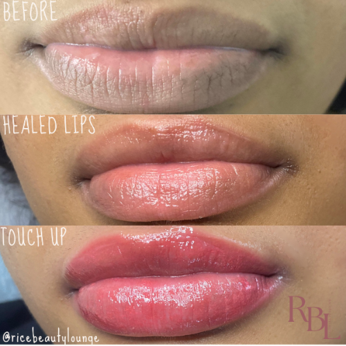 DARK LIP NEUTRALIZER