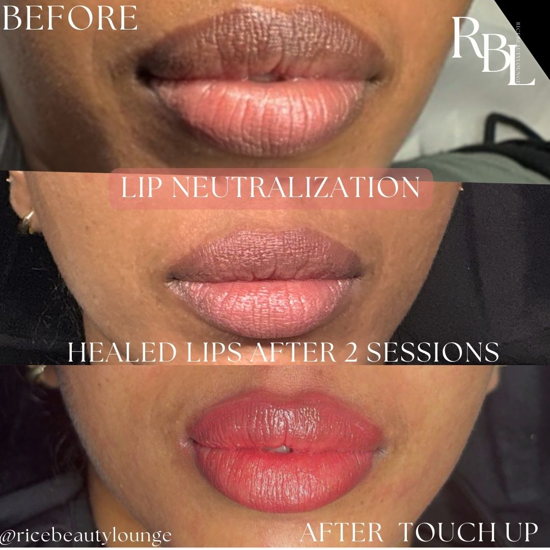 💋 3 Sessions – Balanced Beauty Bundle