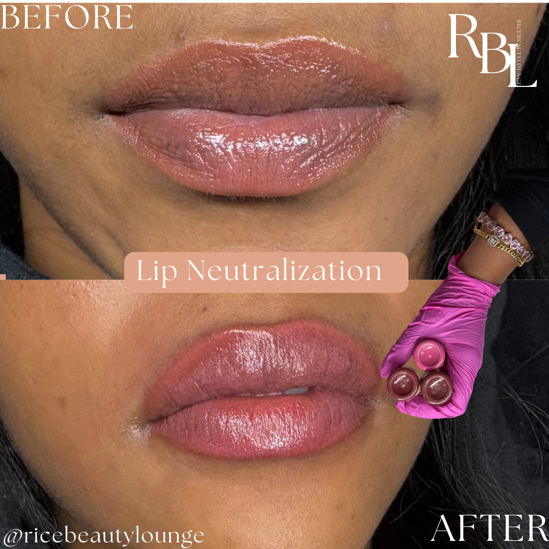 💖 2 Sessions – Lip Reset Duo