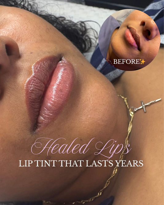 Dark Lip Neutralization 6 Session Package