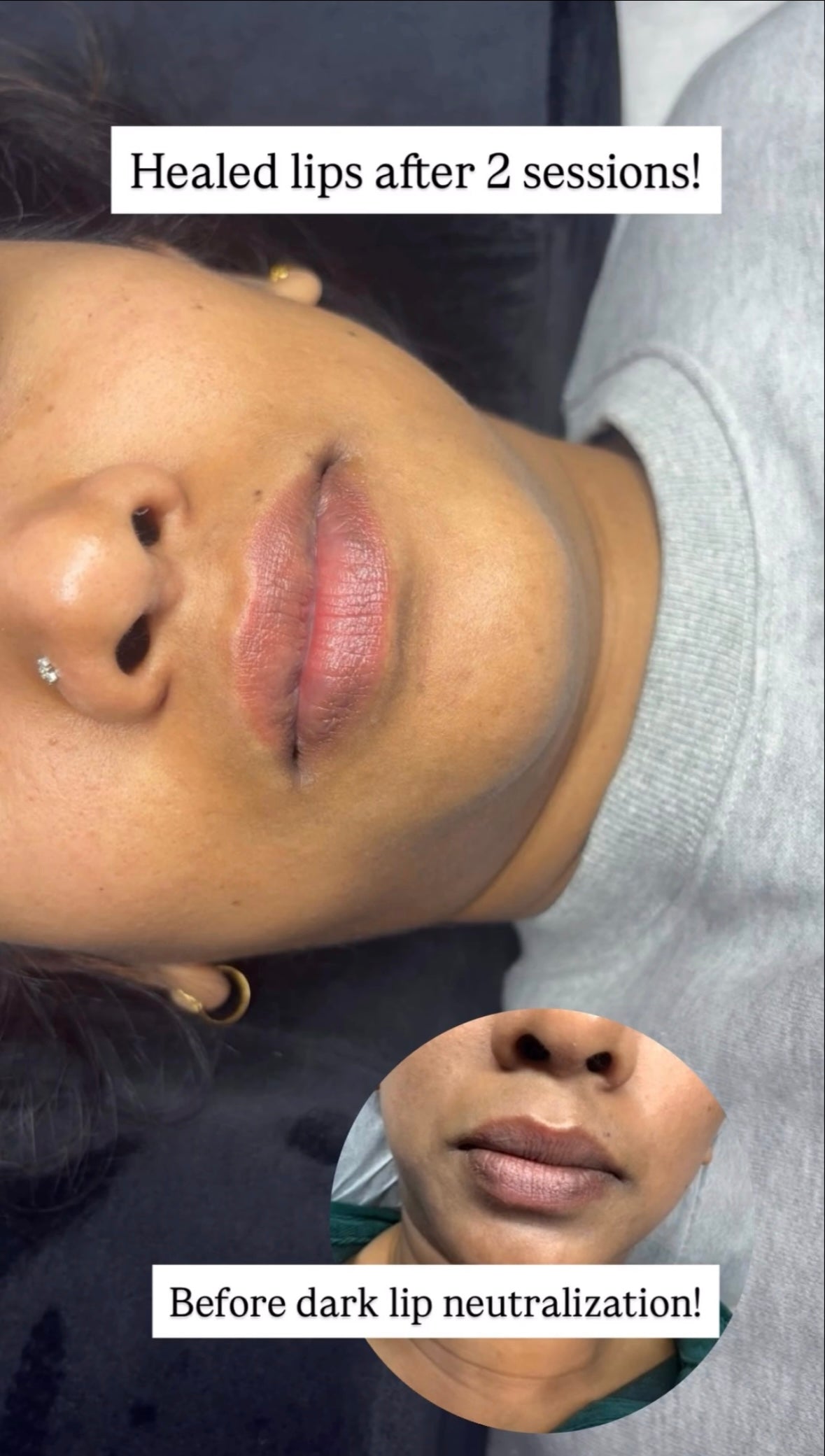 💖 2 Sessions – Lip Reset Duo