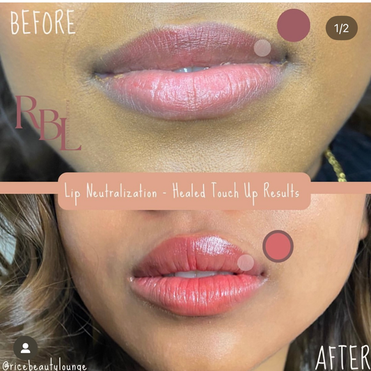 💋 3 Sessions – Balanced Beauty Bundle